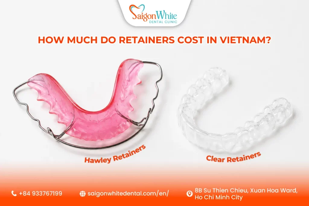 How Much Do Retainers Cost in Vietnam?