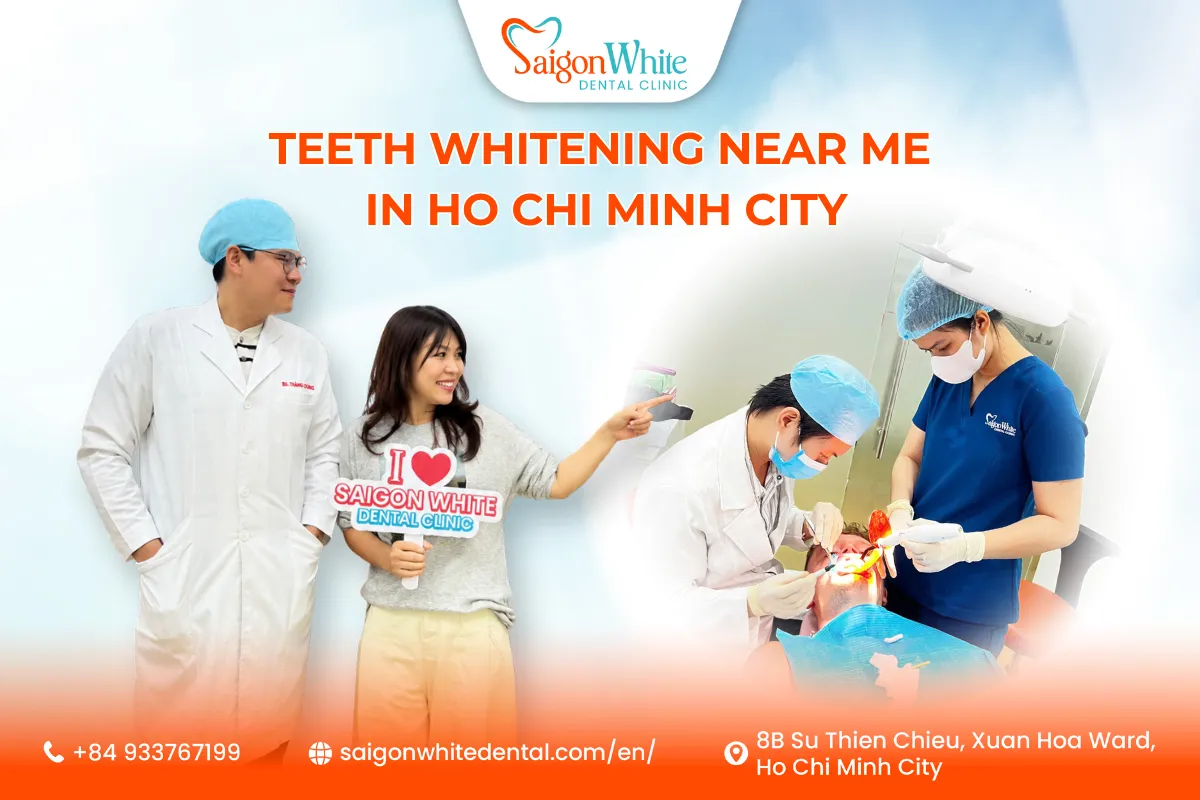 Teeth Whitening Near Me in Ho Chi Minh City - Saigon White Dental Clinic