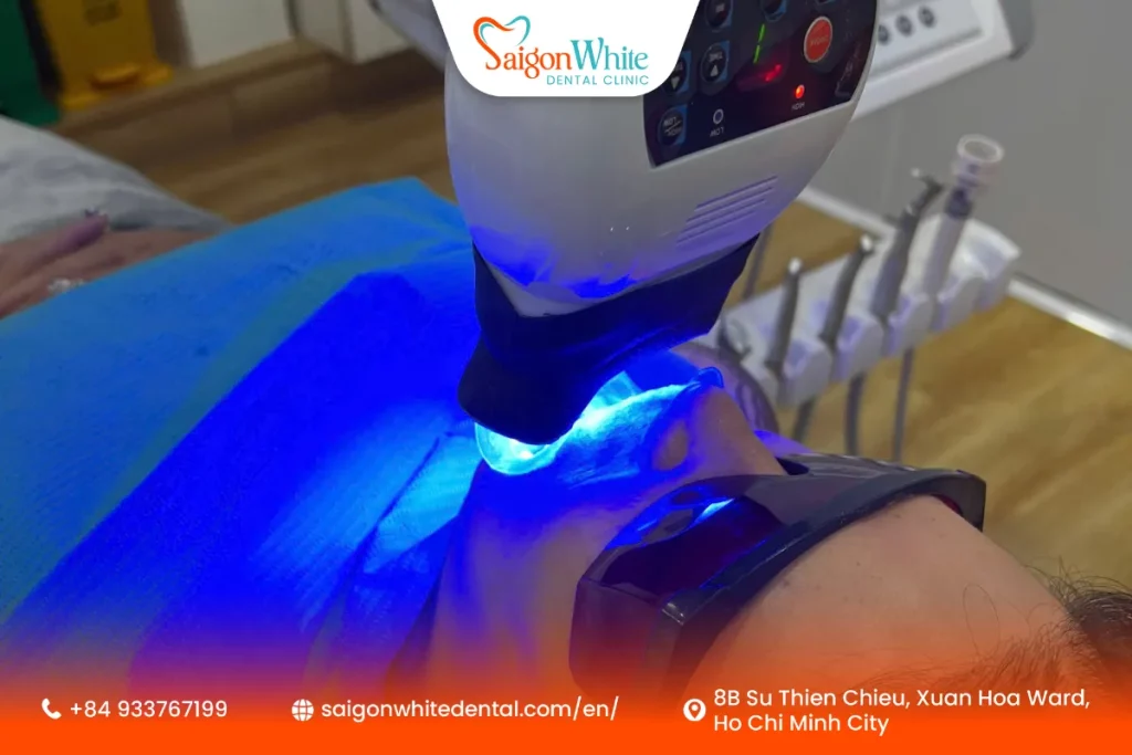 Teeth Whitening at a Teeth Whitening at a Dental Clinic in Vietnam Dental Clinic in Vietnam