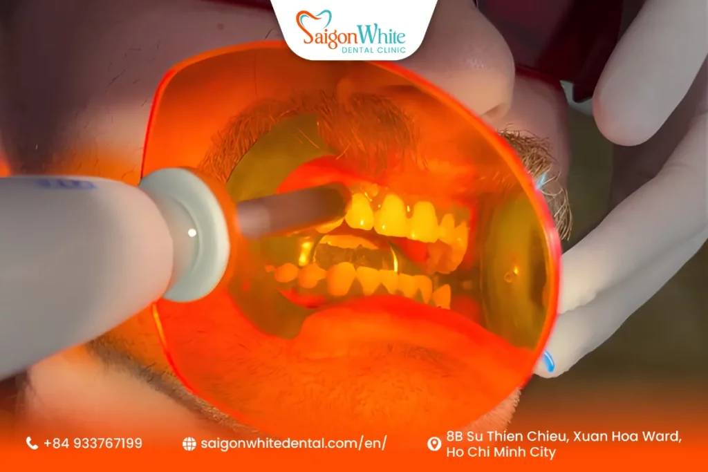 What Is Teeth Whitening