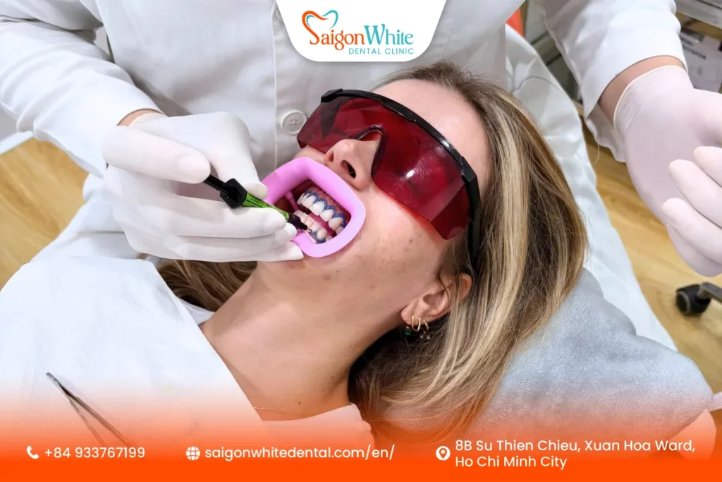 Why Get Teeth Whitening in Vietnam