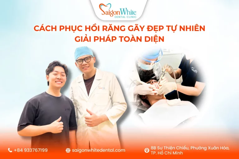 Cách Phục Hồi Răng Gãy Đẹp Tự Nhiên – Giải Pháp Toàn Diện