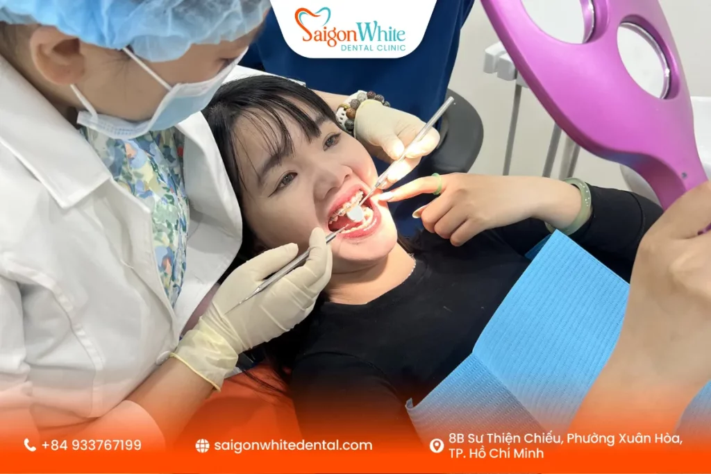 Đơn vị nha khoa cung cấp hàm duy trì chính hãng tại TP.HCM