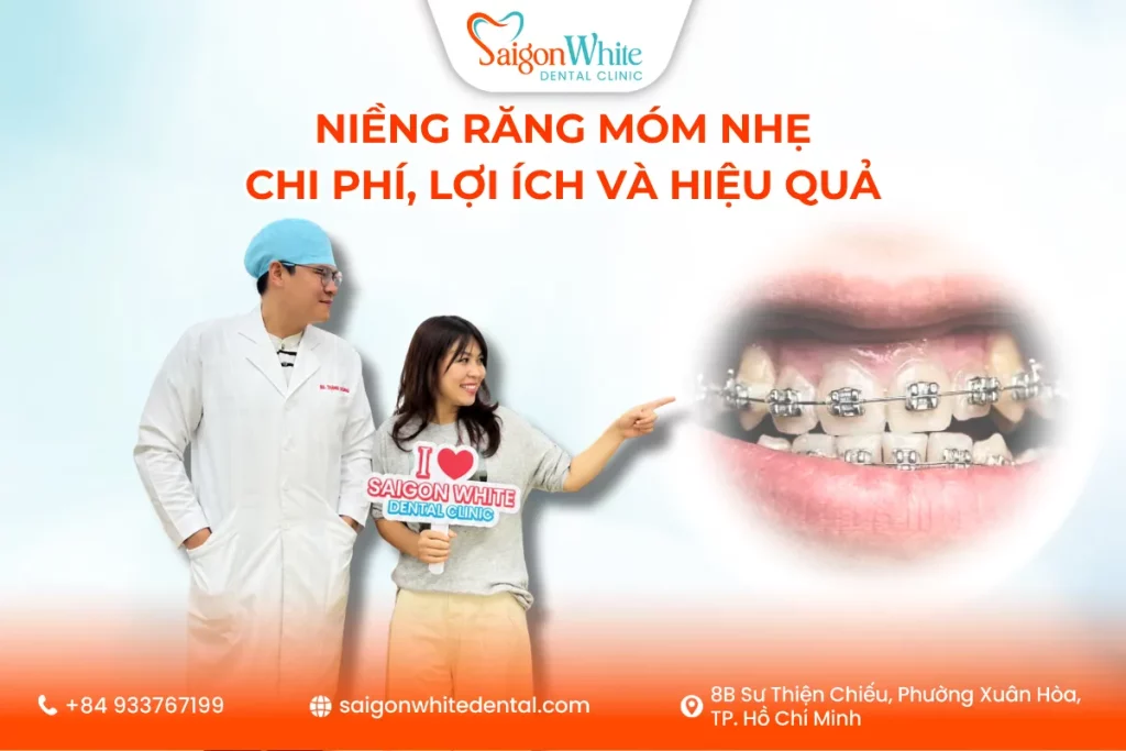 Niềng Răng Móm Nhẹ: Chi Phí, Lợi Ích Và Hiệu Quả