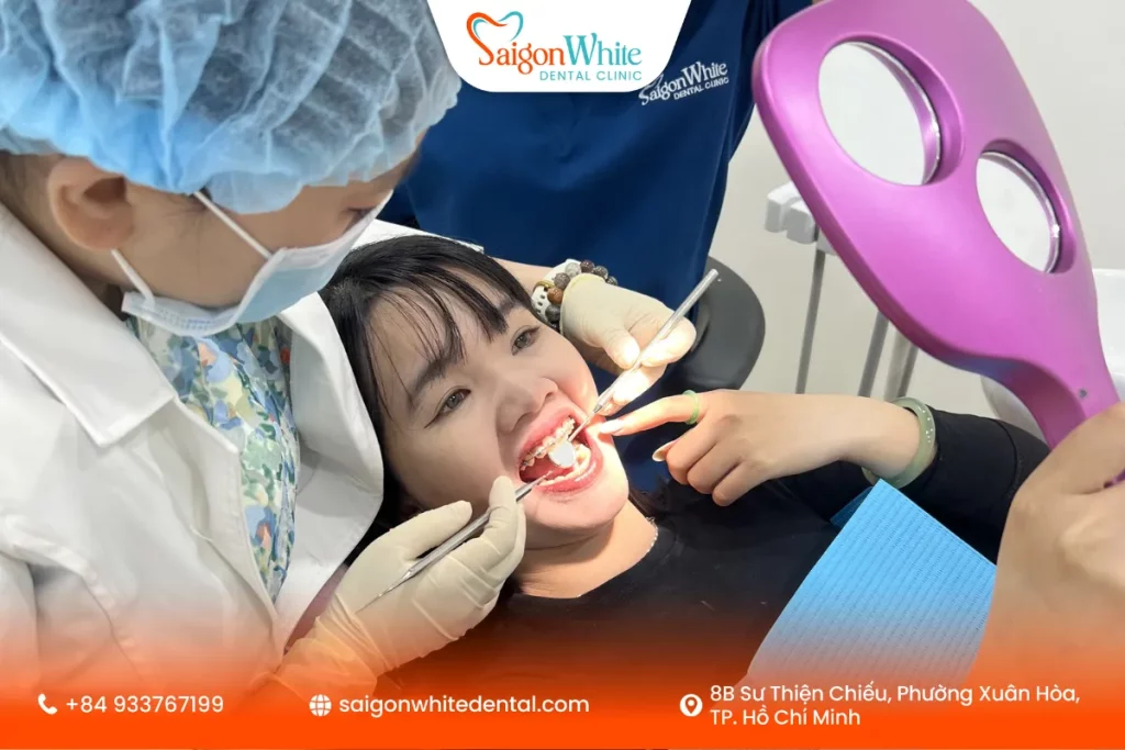 Quy trình niềng răng móm tại Nha khoa Sài Gòn White