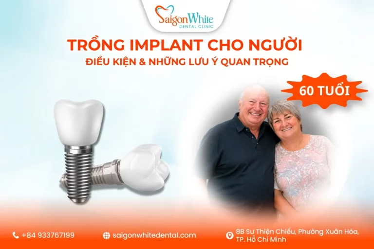 Trồng Implant Cho Người 60 Tuổi: Điều Kiện Và Những Lưu Ý Quan Trọng