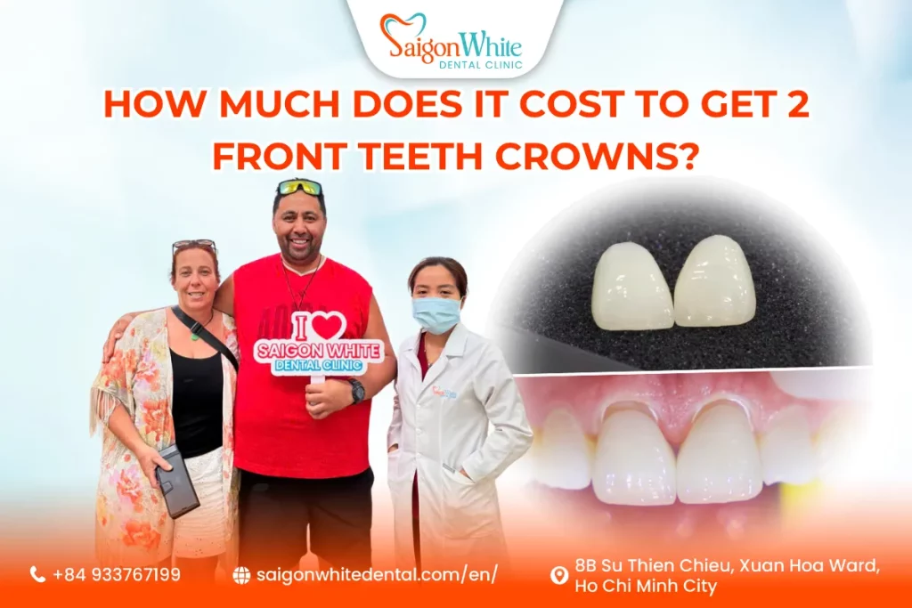 How Much Does It Cost to Get 2 Front Teeth Crowns