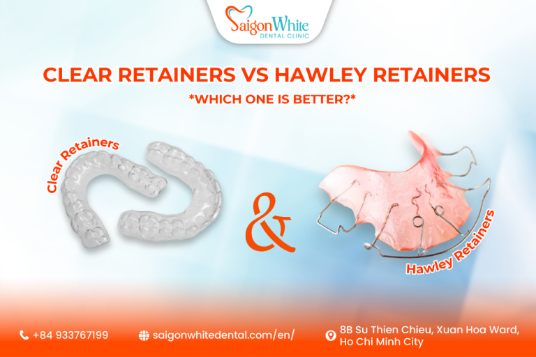 Clear Retainers vs Hawley Retainers Which One Is Better