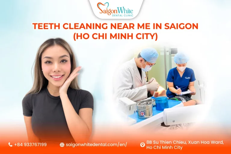 Teeth Cleaning Near Me in Saigon (Ho Chi Minh City)