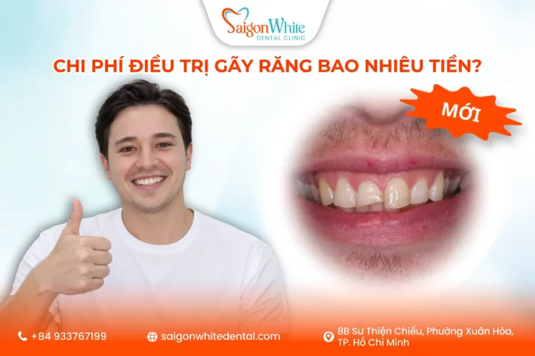 Chi Phí Điều Trị Gãy Răng Bao Nhiêu Tiền?
