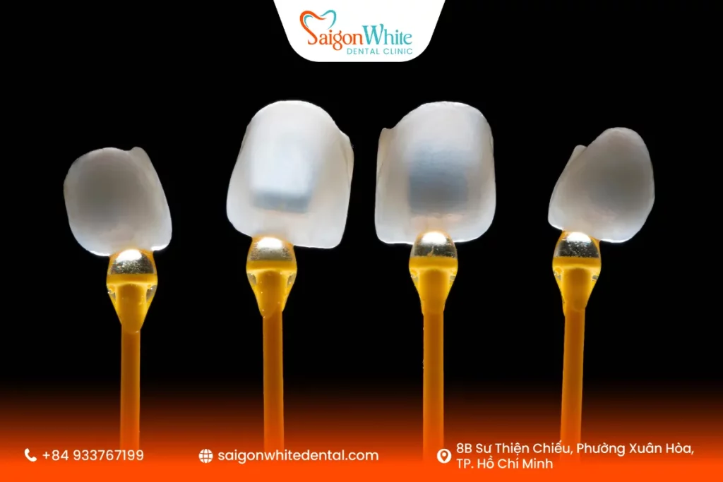 Dán sứ Veneer