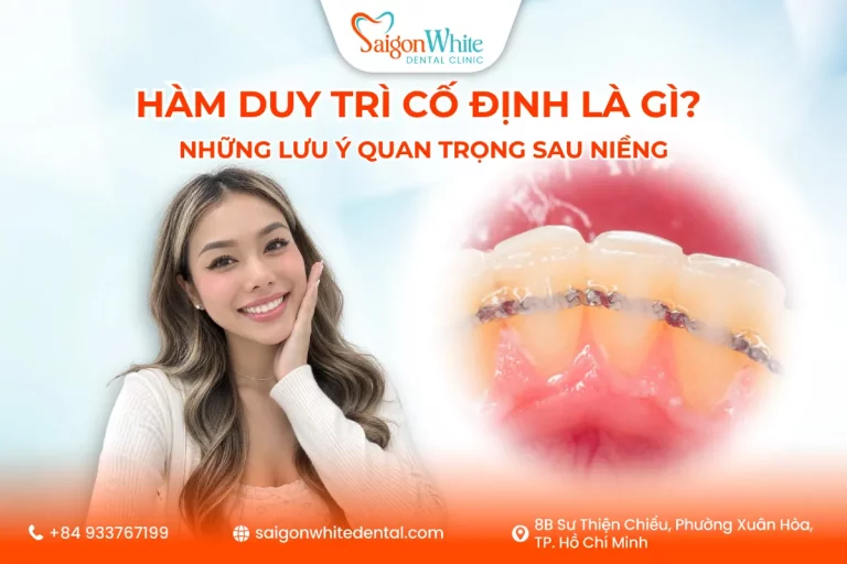Hàm Duy Trì Cố Định Là Gì? Những Lưu Ý Quan Trọng Sau Niềng