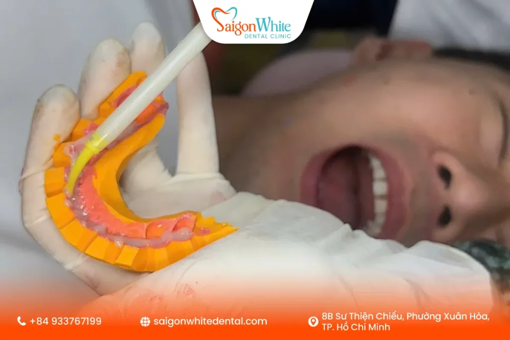 Lấy mẫu răng để thiết kế nụ cười theo cá nhân cho khách hàng