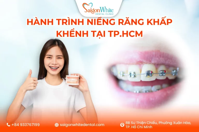 Hành Trình Niềng Răng Khấp Khểnh Tại TP.HCM