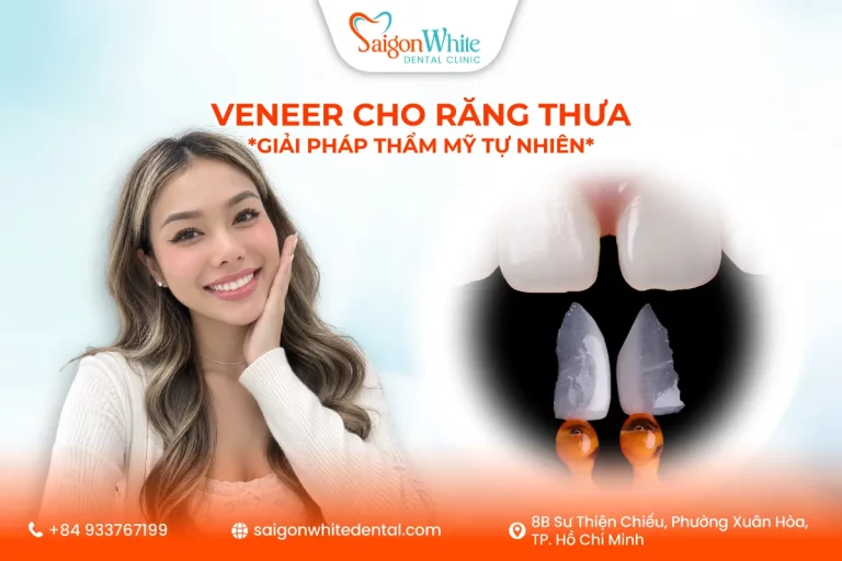 Veneer cho răng thưa: Giải pháp thẩm mỹ tự nhiên